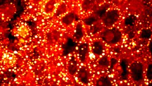 04_NIHCancerCells-1024x576.jpg