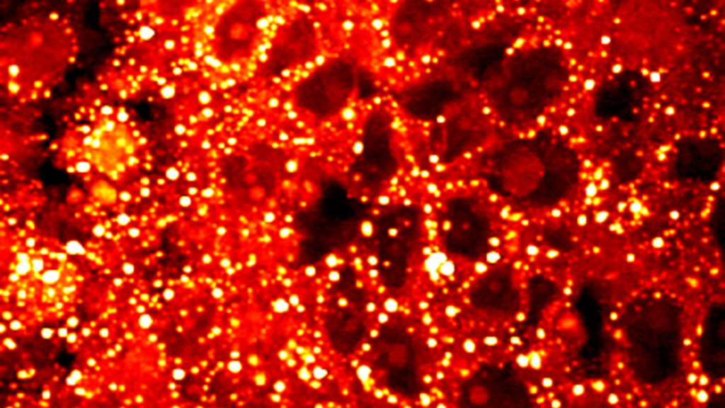 04_NIHCancerCells-1024x576.jpg
