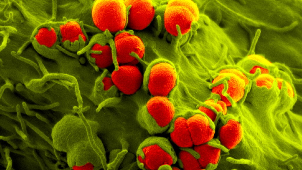 B2201414-Gonorrhoea_bacteria_SEM-1024x576.jpg