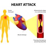 A Fashionable Historical past of the Food regimen-Coronary heart Speculation